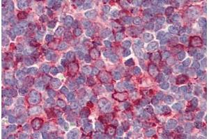 anti-G Protein-Coupled Receptor 26 (GPR26) (Internal Region) antibody