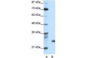 WB Suggested Anti-SAP30 Antibody Titration:  1. (SAP30 anticorps  (N-Term))