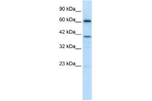 WB Suggested Anti-PRDM14 Antibody Titration: 1. (PRDM14 anticorps  (Middle Region))