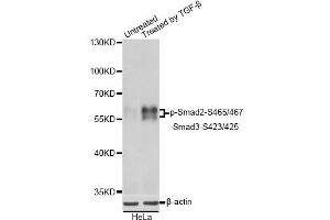 Western blot analysis of extracts of HeLa cells, using Phospho-Smad2-S465/467/-Smad3-S423/425 antibody. (SMAD2 / SMAD3 (pSer423), (pSer425) anticorps)