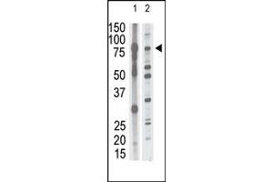 The anti-P15 N-term Antibody (ABIN390139 and ABIN2840643) is used in Western blot to detect P15 in mouse brain tissue lysate (lane 1) and HL60 cell lysate (lane 2) lysate. (MMP15 anticorps  (N-Term))