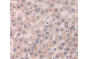 IHC-P analysis of Rat Tissue, with DAB staining. (Thymic Stromal Lymphopoietin anticorps  (AA 75-196))