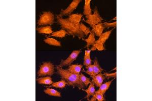 Immunofluorescence analysis of C6 cells using AIRE Rabbit pAb (ABIN3022514, ABIN3022515, ABIN3022516 and ABIN6218869) at dilution of 1:100. (AIRE anticorps  (AA 30-130))