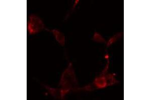 ABIN6274886 staining HeLa cells by IF/ICC. (ABCF1 anticorps  (C-Term))