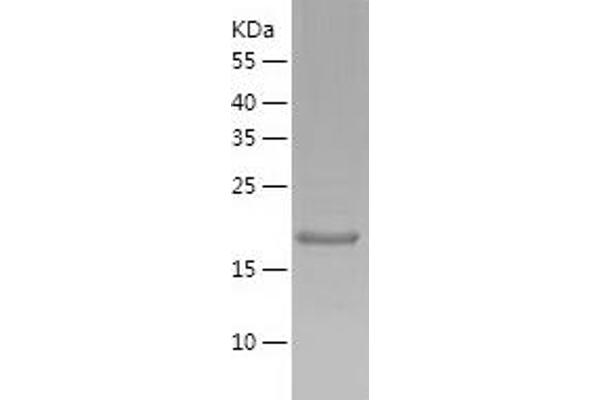 FGF18 Protein (AA 28-207) (His tag)