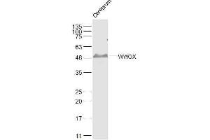 Mouse cerebrum lysates probed with WWOX Polyclonal Antibody, Unconjugated  at 1:500 dilution and 4˚C overnight incubation. (WWOX anticorps  (AA 5-100))