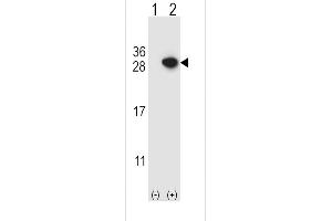 Western blot analysis of ARHGDIA using rabbit polyclonal ARHGDIA Antibody using 293 cell lysates (2 ug/lane) either nontransfected (Lane 1) or transiently transfected (Lane 2) with the ARHGDIA gene. (ARHGDIA anticorps  (C-Term))