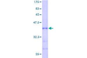 SDS-PAGE (SDS) image for 4-Aminobutyrate Aminotransferase (ABAT) (AA 1-116) protein (GST tag) (ABIN1774924)