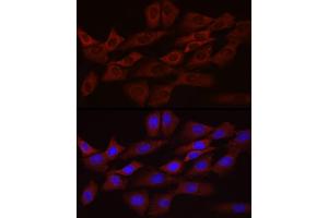 Immunofluorescence analysis of NIH/3T3 cells using Bcl-2 Mouse mAb (ABIN7265809) at dilution of 1:100 (40x lens). (Bcl-2 anticorps)