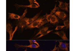 Immunofluorescence analysis of C6 cells using RPL36AL Polyclonal Antibody at dilution of 1:100 (40x lens). (RPL36AL anticorps)