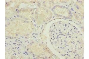 Immunohistochemistry of paraffin-embedded human kidney tissue using ABIN7159124 at dilution of 1:100 (MED22 anticorps  (AA 2-140))