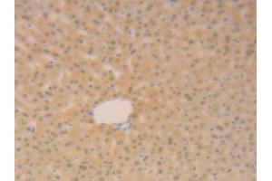 IHC-P analysis of Mouse Liver Tissue, with DAB staining. (SFTPB anticorps  (AA 20-193))