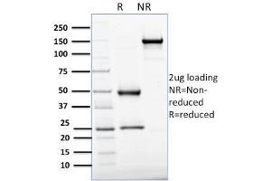 SDS-PAGE Analysis Purified APEX Nuclease I Mouse Monoclonal Antibody (CPTC-APEX1-2). (SHP1 anticorps)
