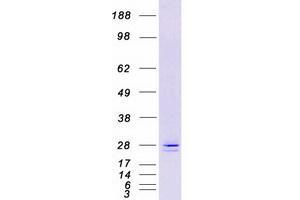 Validation with Western Blot