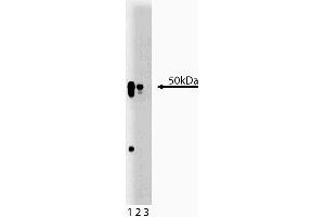 Western blot analysis of AP50 on a rat cerebrum lysate. (AP2M1 anticorps  (AA 110-230))