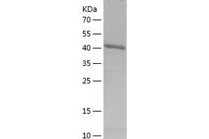 Western Blotting (WB) image for Density-Regulated Protein (DENR) (AA 1-198) protein (His-IF2DI Tag) (ABIN7122631)