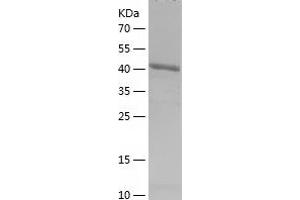 Western Blotting (WB) image for Density-Regulated Protein (DENR) (AA 1-198) protein (His-IF2DI Tag) (ABIN7122631) (Density Regulated Protein Protein (AA 1-198) (His-IF2DI Tag))