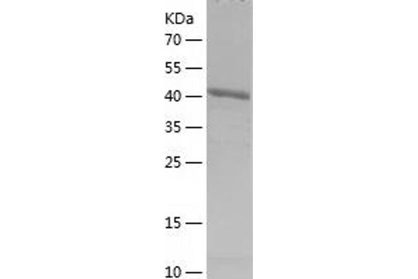 Density Regulated Protein Protein (AA 1-198) (His-IF2DI Tag)