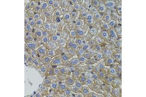 Immunohistochemistry of paraffin-embedded mouse liver using Mitofusin 2 antibody (ABIN6128301, ABIN6143801, ABIN6143804 and ABIN6217669) (40x lens).