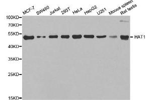 Western Blotting (WB) image for anti-Histone Acetyltransferase 1 (HAT1) antibody (ABIN1882320) (HAT1 anticorps)