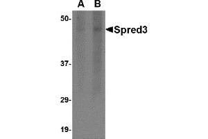 Western Blotting (WB) image for anti-Sprouty-Related, EVH1 Domain Containing 3 (SPRED3) (Middle Region) antibody (ABIN1031104) (SPRED3 anticorps  (Middle Region))
