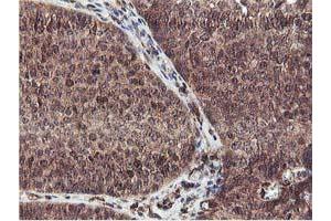 Image no. 10 for anti-Epsin 2 (EPN2) antibody (ABIN1498049)