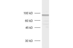 dilution: 1 : 1000, sample: rat retina extract (MPP5 anticorps  (AA 2-244))