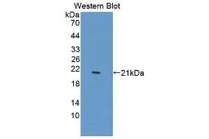 Detection of Recombinant PTPN13, Mouse using Polyclonal Antibody to Protein Tyrosine Phosphatase, Non Receptor Type 13 (PTPN13)