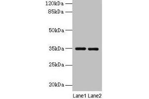 Western blot All lanes: Thpo antibody at 4 μg/mL Lane 1: Mouse liver tissue Lane 2: 293T whole cell lysate Secondary Goat polyclonal to rabbit IgG at 1/10000 dilution Predicted band size: 35 kDa Observed band size: 35 kDa (Thrombopoietin anticorps  (AA 22-194))