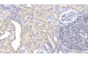 Detection of GFRa1 in Human Kidney Tissue using Polyclonal Antibody to Glial Cell Line Derived Neurotrophic Factor Receptor Alpha 1 (GFRa1)