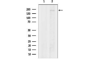 anti-MYST Histone Acetyltransferase (Monocytic Leukemia) 3 (MYST3) (N-Term) antibody