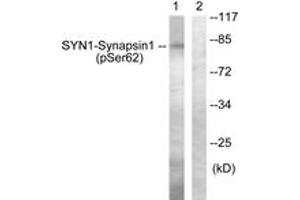 Western blot analysis of extracts from HeLa cells treated with Anisomycin 25ug/ml 30', using Synapsin1 (Phospho-Ser62) Antibody. (SYN1 anticorps  (pSer62))