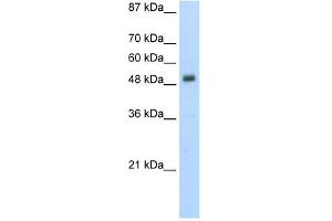 Desmin antibody used at 5 ug/ml to detect target protein. (Desmin anticorps  (N-Term))