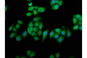 Immunofluorescence staining of Hela cells with ABIN7167824 at 1:233, counter-stained with DAPI. (RPE65 anticorps  (AA 348-484))