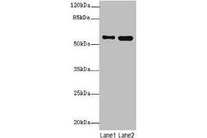 Western blot All lanes: STAM2 antibody at 4. (STAM2 anticorps  (AA 376-525))