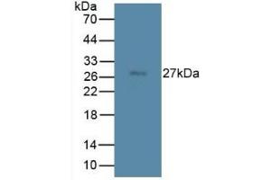 Detection of TMEM27 in Rat Spleen Tissue using Monoclonal Antibody to Transmembrane Protein 27 (TMEM27) (TMEM27 anticorps  (AA 12-222))