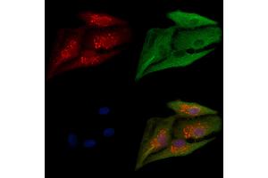 ABIN6264148 and ABIN6279651 staining  cells by IF/ICC. (PEX12 anticorps  (Internal Region))