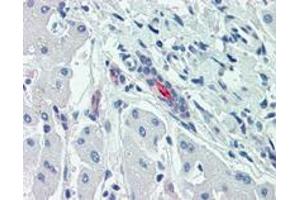 Immunohistochemistry (Formalin/PFA-fixed paraffin-embedded sections) of human liver with SLC5A1 polyclonal antibody .