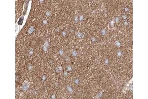 ABIN6267254 at 1/200 staining human brain tissue sections by IHC-P. (ABL1 anticorps  (pTyr245))