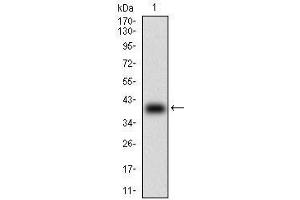 Western blot analysis using B2M mAb against human B2M (AA: 21-100) recombinant protein.