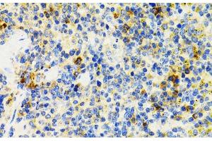 Immunohistochemistry of paraffin-embedded Mouse spleen using SH2B1 Polyclonal Antibody at dilution of 1:100 (40x lens). (SH2B1 anticorps)