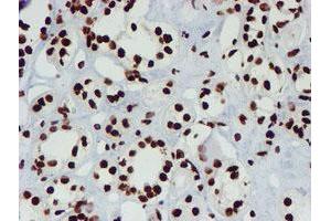Immunohistochemical staining of paraffin-embedded Human Kidney tissue using anti-NONO mouse monoclonal antibody. (NONO anticorps  (AA 184-385))