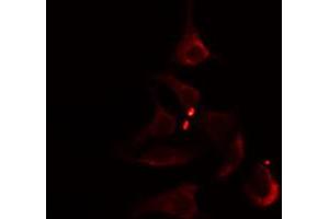 ABIN6274804 staining Hela cells by IF/ICC. (ACOT1 anticorps  (Internal Region))
