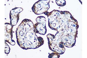 Immunohistochemistry of paraffin-embedded Human placenta using YTHDF2 antibody (ABIN7271427) at dilution of 1:100 (40x lens).