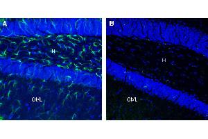 Expression of CLEC7A/Dectin-1 in mouse hippocampus.