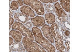 ABIN6266504 at 1/200 staining human kidney tissue sections by IHC-P. (JUP anticorps  (C-Term))