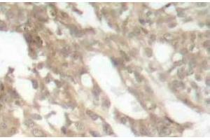 Immunohistochemistry (IHC) analyzes of PKC theta antibody in paraffin-embedded human skeletal muscle tissue. (PKC theta anticorps)