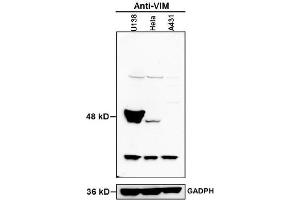 20 μg proteins of cell lysates from U138, HeLa and A431 were separated by SDS-PAGE and transferred to PVDF membrane for western blotting analysis antibodies against protein VIM at dilution of 1:1000 with exposure time of 10 seconds.
