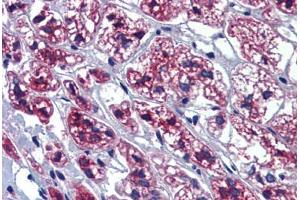 Human Adrenal (formalin-fixed, paraffin-embedded) stained with GTPBP10 antibody ABIN462237 followed by biotinylated goat anti-rabbit IgG secondary antibody ABIN481713, alkaline phosphatase-streptavidin and chromogen.