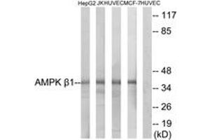 Western blot analysis of extracts from HepG2/Jurkat/HuvEc/MCF-7 cells, using AMPK beta1 (Ab-181) Antibody.